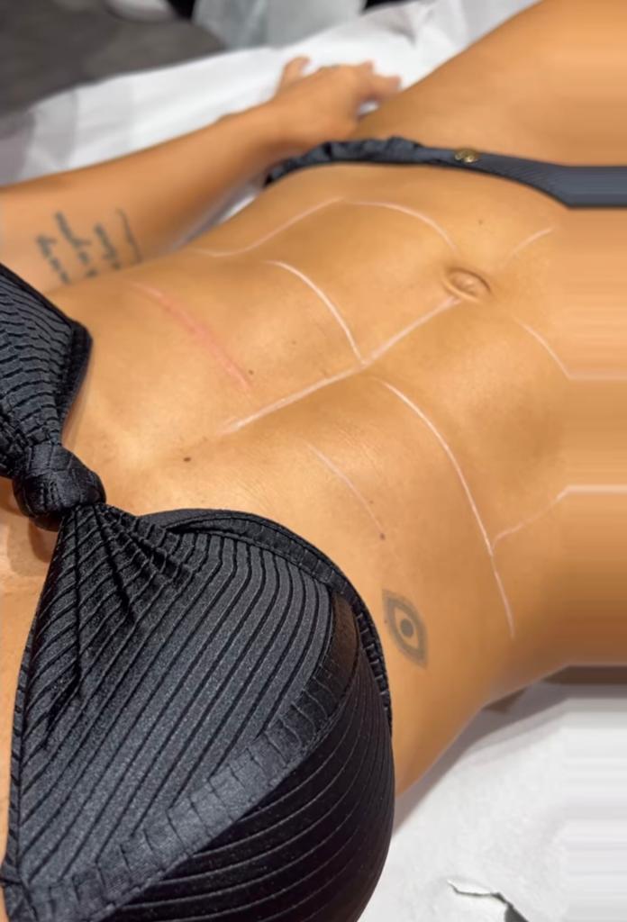 Harmonização corporal das famosas chega em Manaus